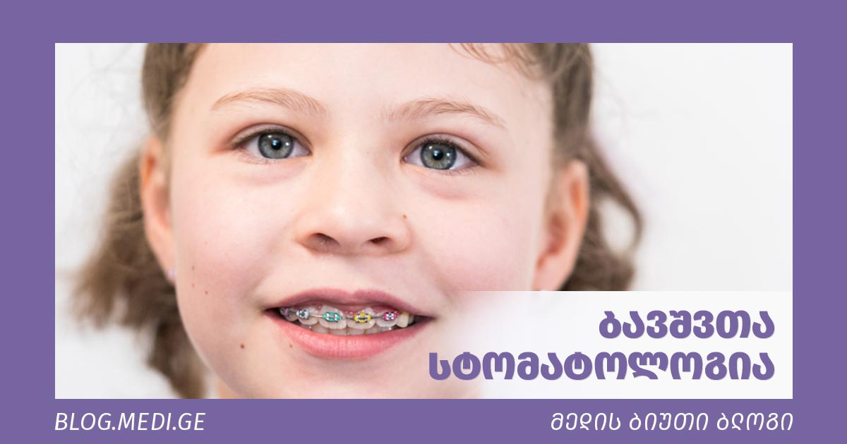 ბავშვთა სტომატოლოგია