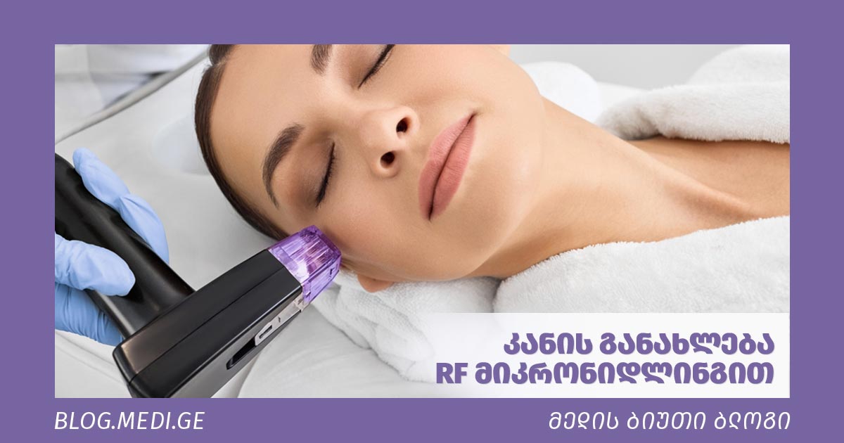 RF-micronidling