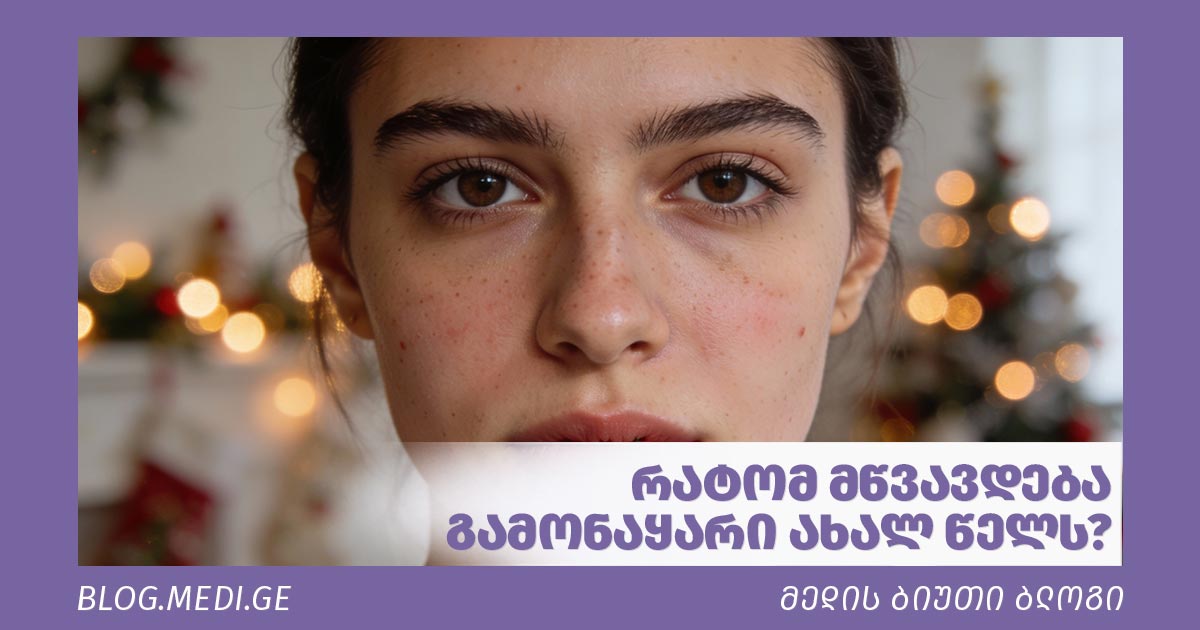 გამონაყარი, აკნე